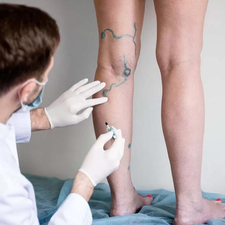 Genetik Varis Riski Olanlar Ne Yapmalı?